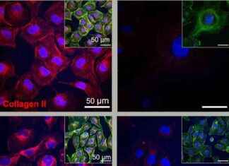 Dancing Molecules Regenerate Cartilage in 3 Days: Study Findings news-28072024-135435