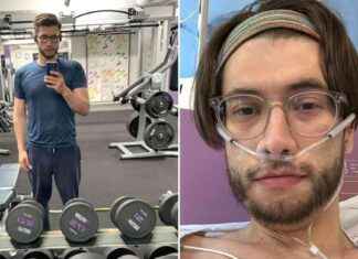 Collapsed Lung Misdiagnosed as Trapped Gas: Gym Addict’s A&E Rush news-13082024-171900
