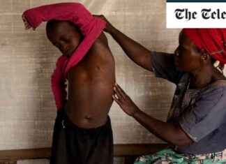 WHO Declares Public Health Emergency Over Rapidly Spreading New Clade of Mpox news-15082024-050955