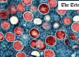 Understanding MPOX: The Latest Public Health Emergency Explained news-15082024-171453