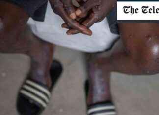 New COVID Variant ‘Potentially Spreading in Europe’ news-16082024-232419