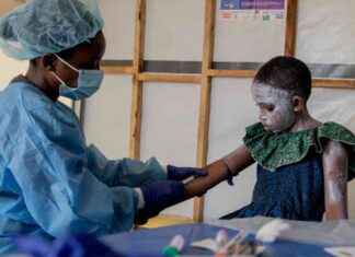 Deadly Mpox Strain Likely Already in UK: Expert Warns news-17082024-052401