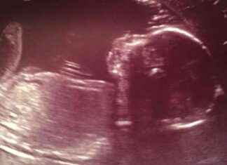 Lack of Accountability for Stillborn Baby’s Care Sparks Anger Among Parents – Concerns Over NHS ‘Religion’ Status news-18082024-223712