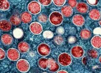 Travel Restrictions for Tourists Flying to Spain Amidst Spread of MPOX news-25082024-115128