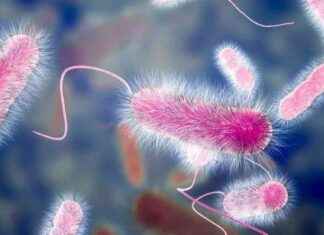 Unsolved Mystery: Stealth Disease Claims Four Lives in Milan news-26082024-235720