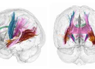 Brain Changes During Pregnancy: What Scans Reveal news-16092024-200407