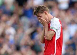 Arsenal Manager Arteta Confirms Odegaard Injury Update: Major Blow news-18092024-210752