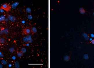 Vitamin A-Activating Drugs Could Help Prevent MND, Study Shows news-20092024-075554