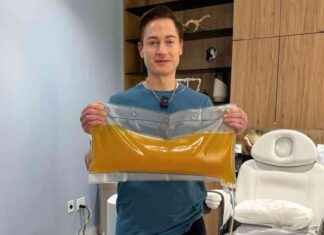 Biohacker Replaces ‘Liquid Gold’ in Body: Multimillionaire’s Transformation news-18102024-102301