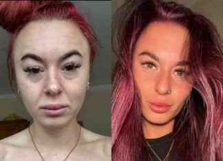 Ketamine Addiction Among Young People in UK: Rehab and Recovery Efforts news-03112024-202924