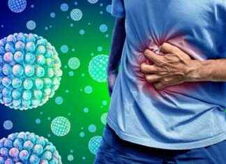 Exploring the Latest Norovirus Strain Spreading in the UK news-11112024-084628