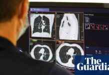 Keir Starmer Announces NHS Overhaul for Reduced Waiting Times keir-starmer-announces-nhs-overhaul-for-reduced-waiting-times